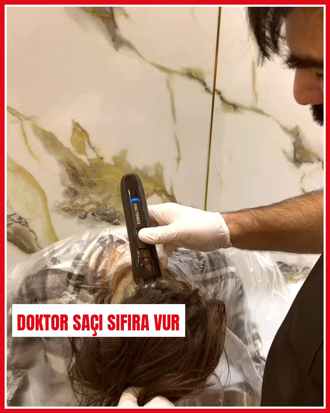 Saçlı deri mantarı bulaşıcı olduğu için berber aletlerinin