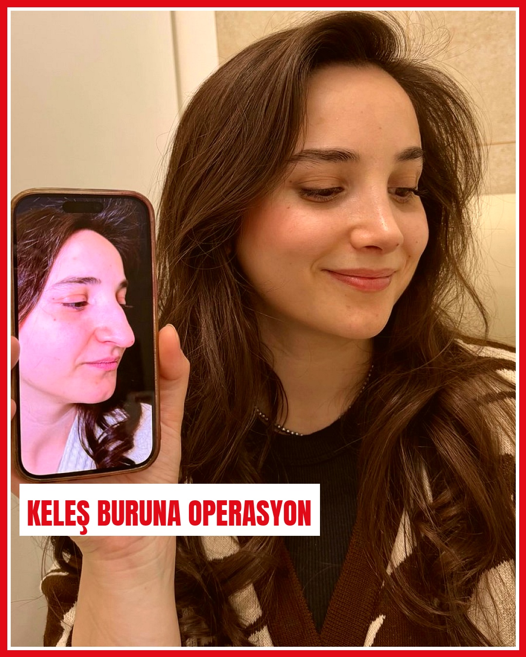 Arkadaşlarının sözleri üzerine burun operasyonu geçiren kadın son