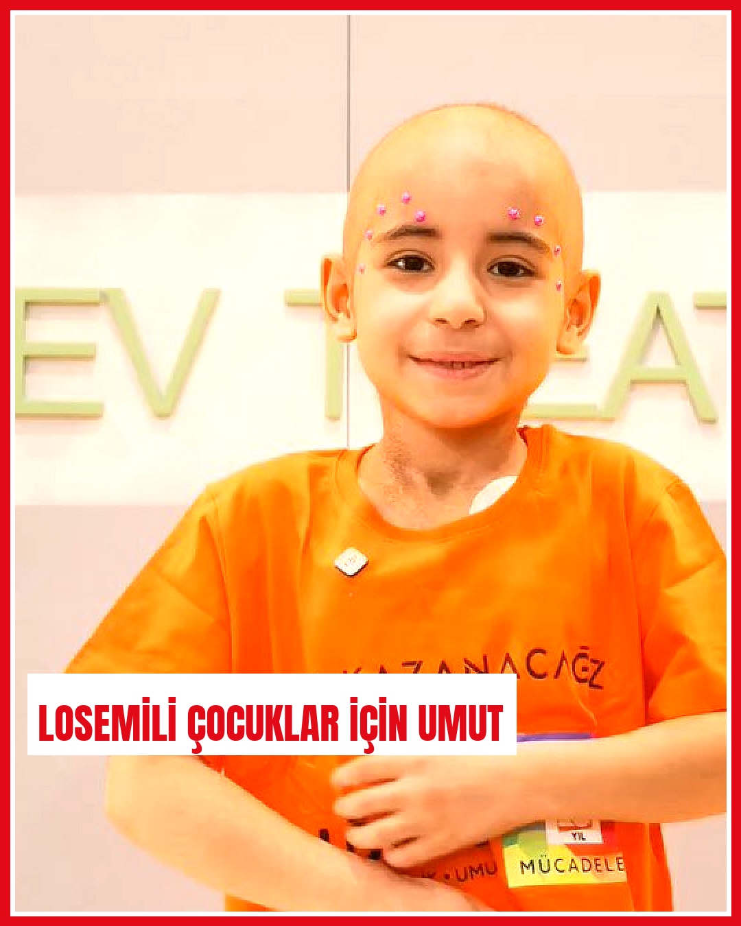 Lösemili Çocuklar Haftası 2-8 Kasım tarihlerinde kutlanacak